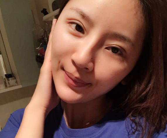 北京悦丽格医疗美容诊所_周宜国_整形日记案例_自体
