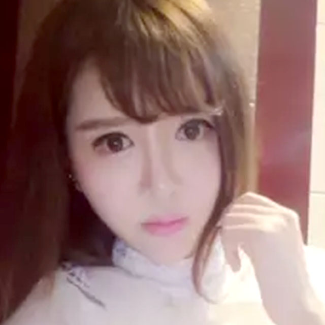 自体脂肪+玻尿酸