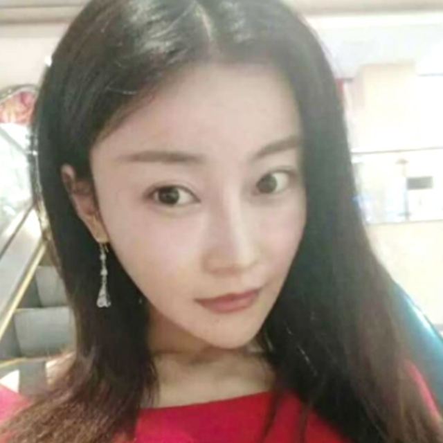 ZJ无极下巴+JM脂肪活力面部填充